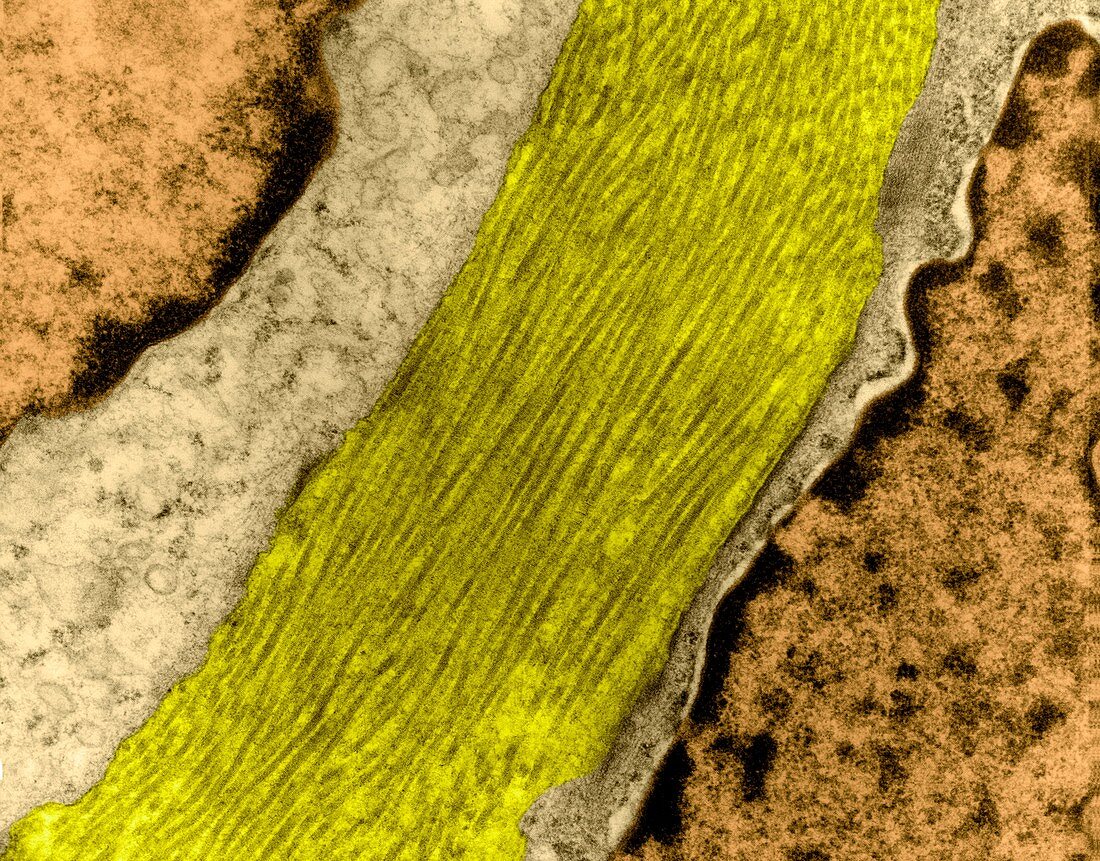 Collagen fibres, TEM