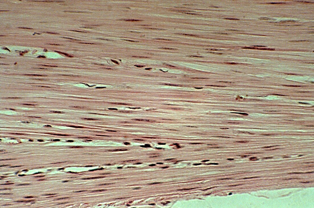 Trachea smooth muscle, LM Brightfield