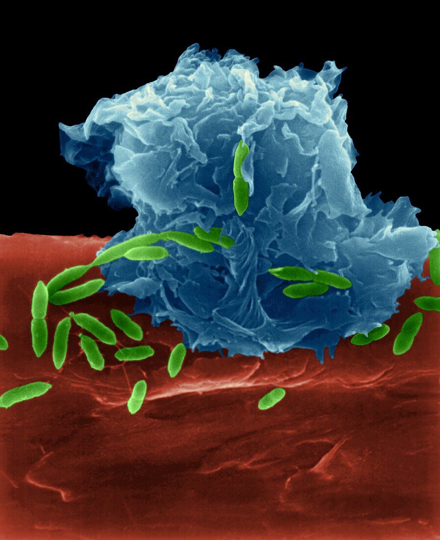 Alveolar macrophage phagocytosis of E. coli, SEM