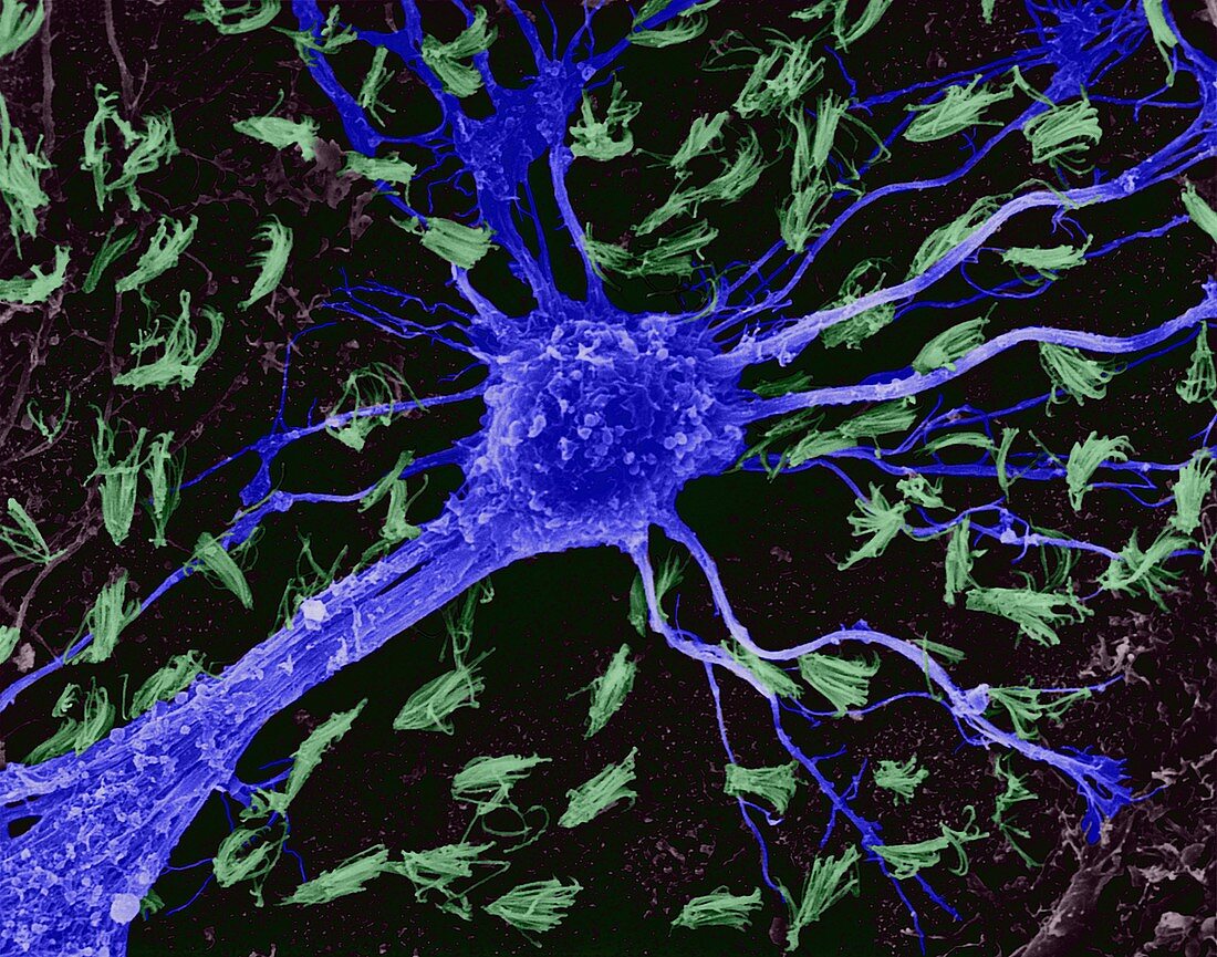 Astrocytic glial cell from CNS, SEM