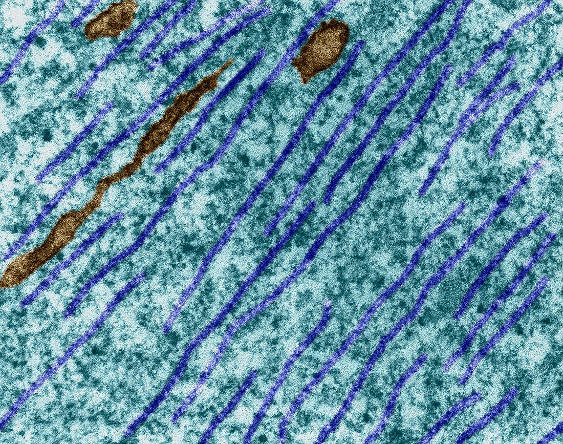 Microtubules in a dendrite, TEM