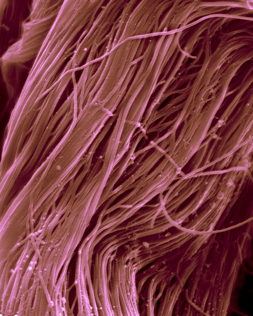 Heart muscle collagen fibres, SEM