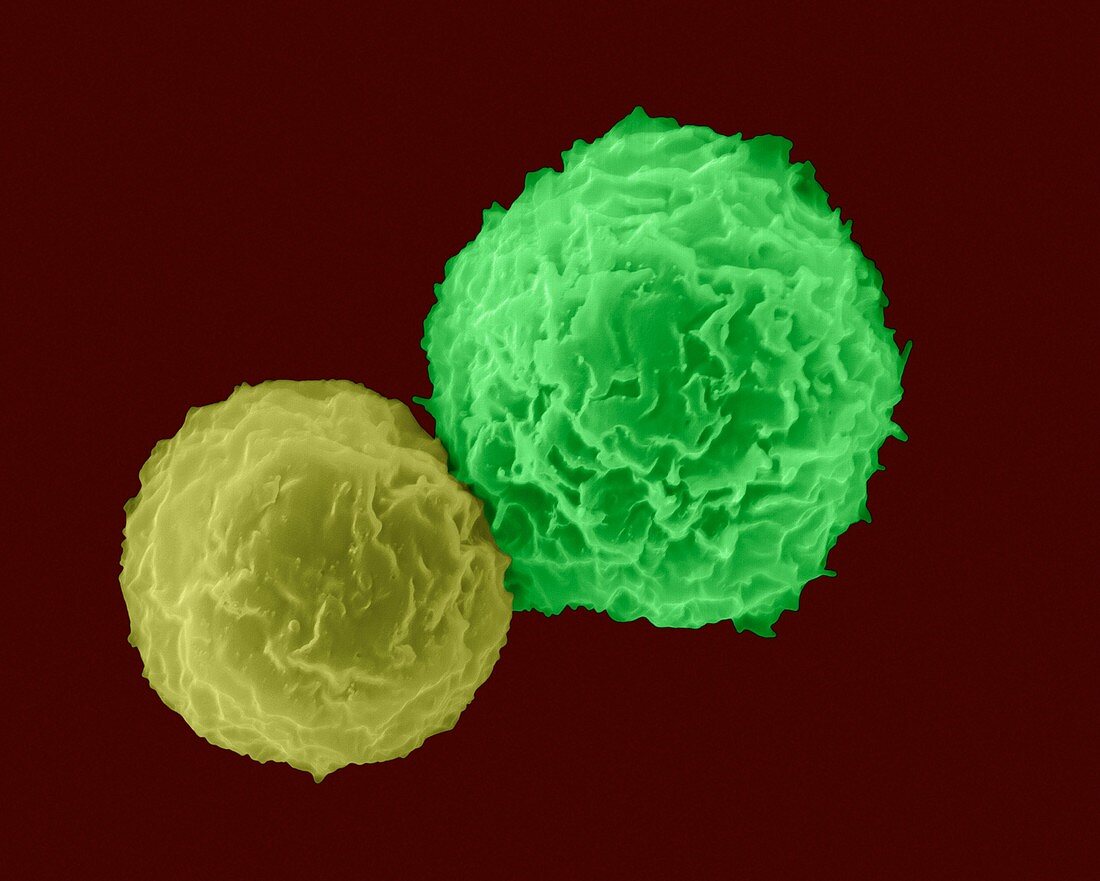 Helper T cell and B cell, SEM