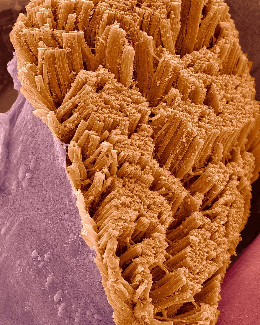 Skeletal muscle actin myosin filaments, SEM