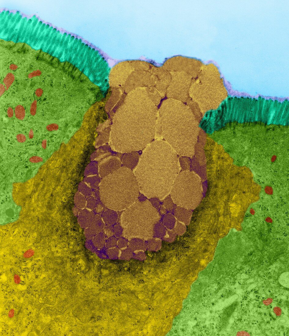 Goblet cell in the lining of the nasal epithelium, TEM