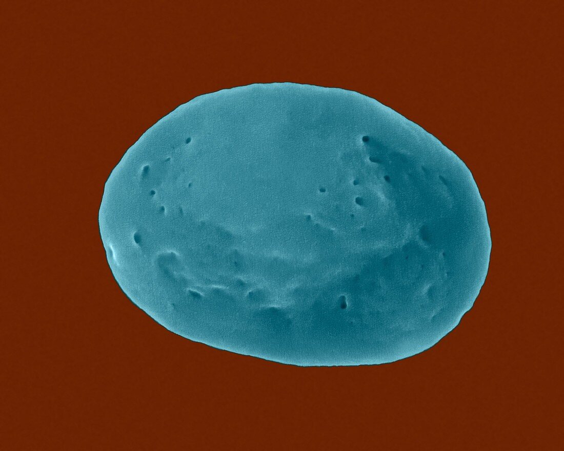 Non-activated platelet and open canalicular system, SEM