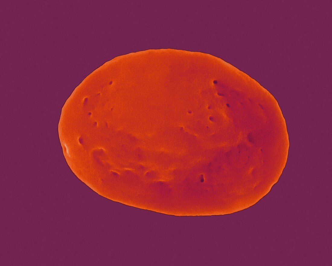 Non-activated platelet and open canalicular system, SEM
