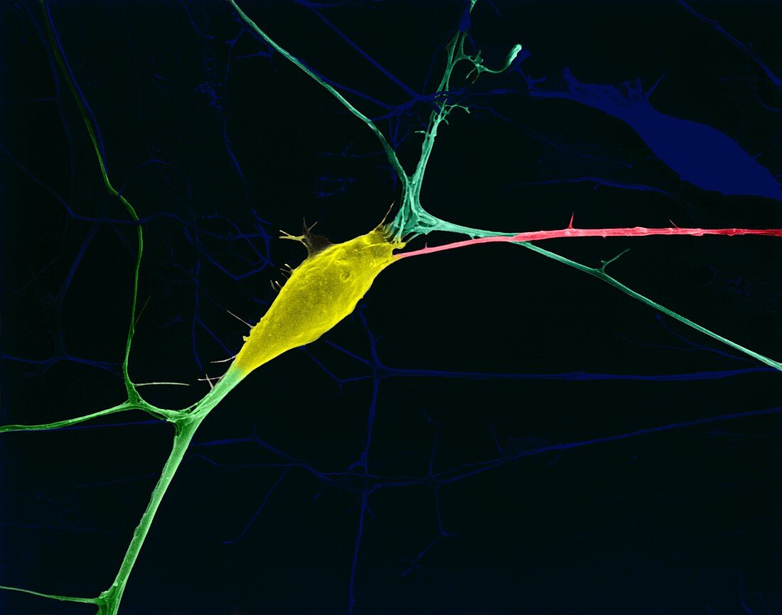 Neuron growing in culture, SEM