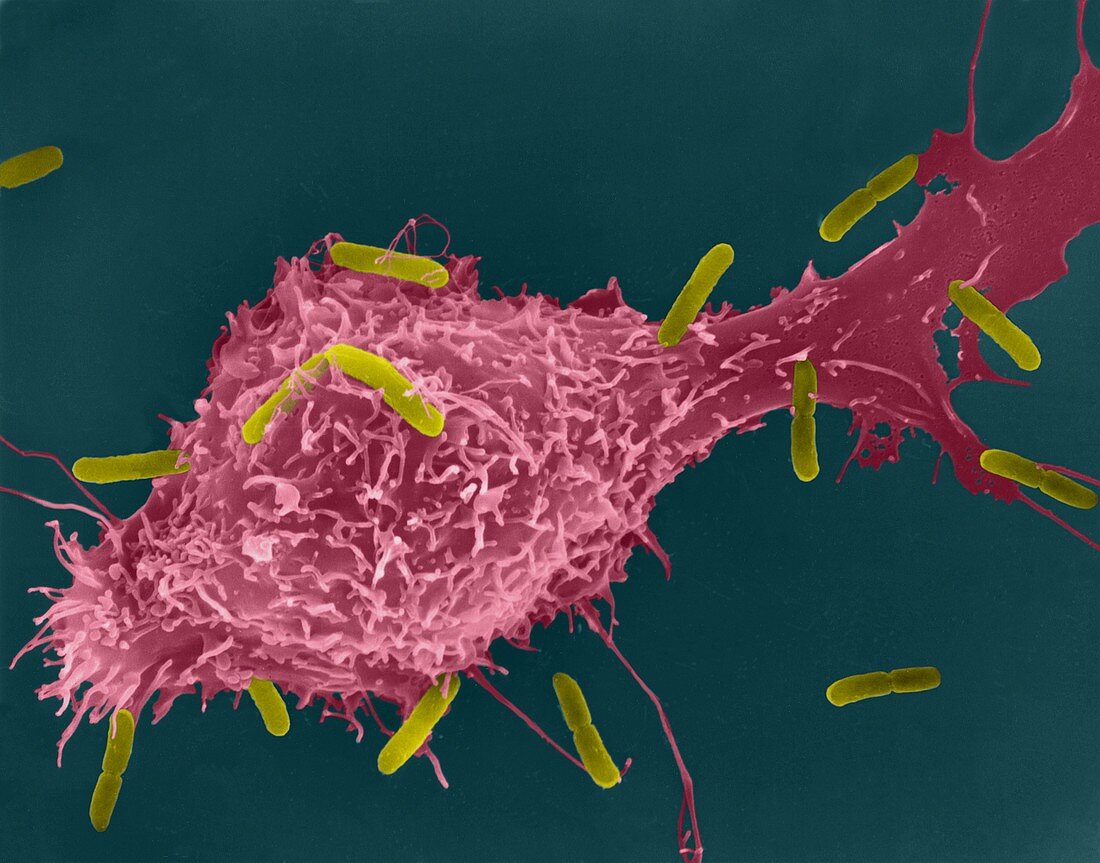 Peritoneal macrophage phagocytosis of E. coli, SEM