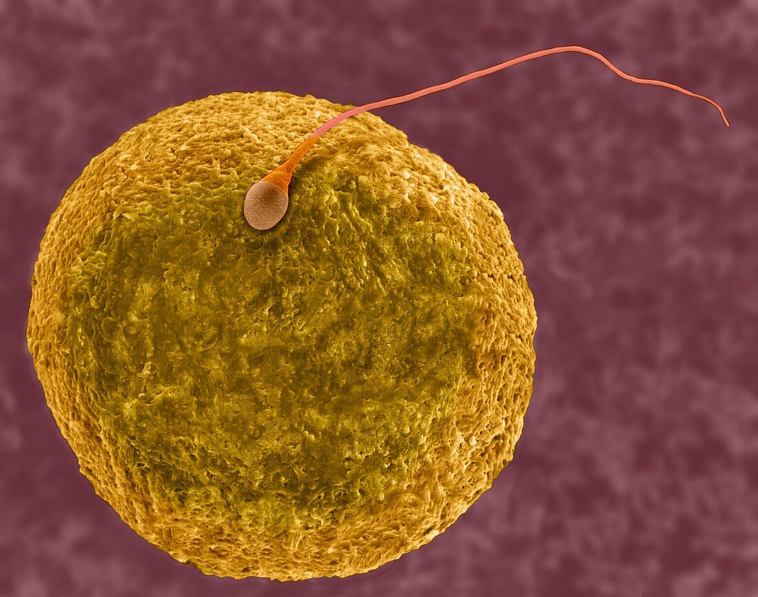 Human egg and sperm, SEM