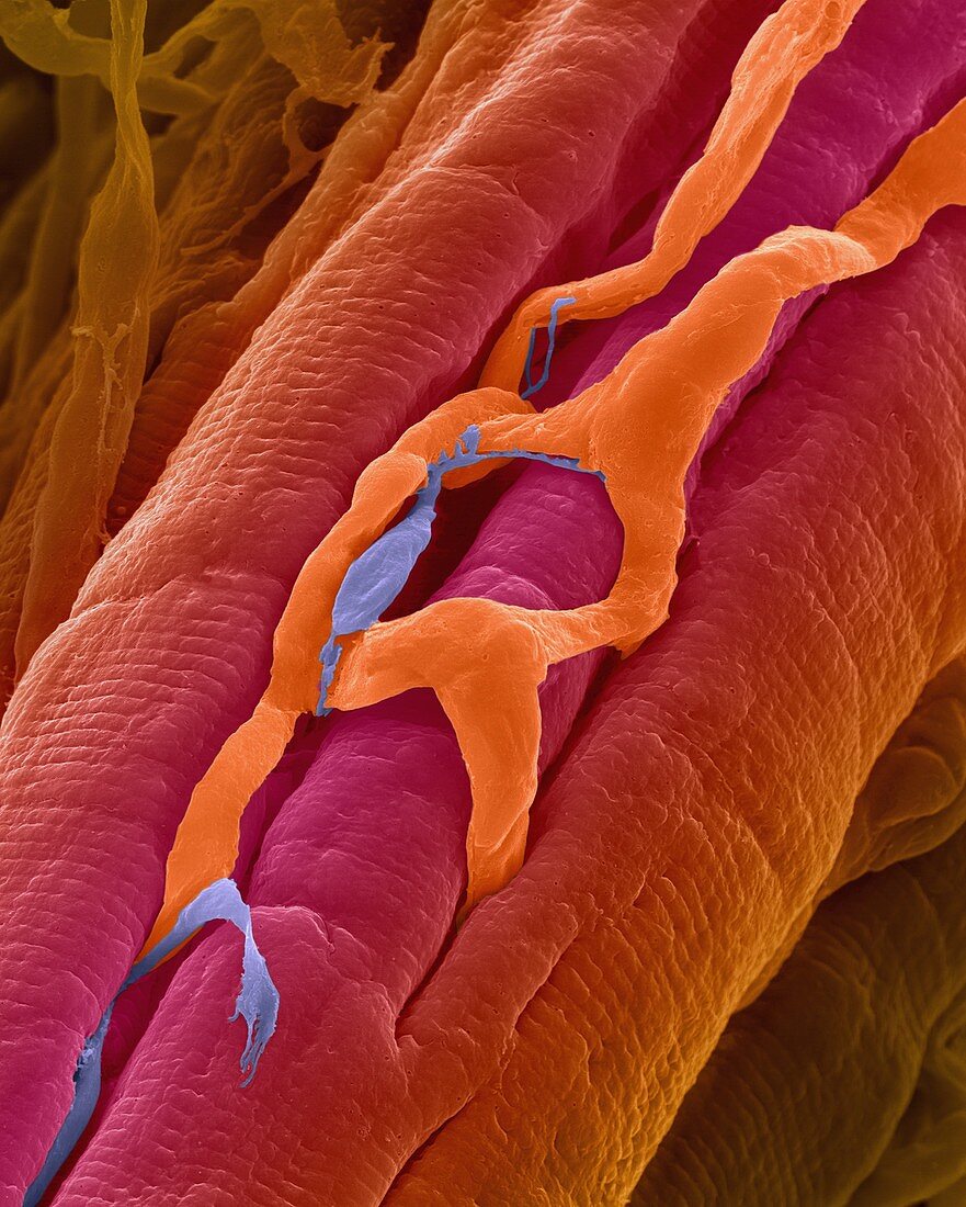 Heart muscle and capillaries, SEM