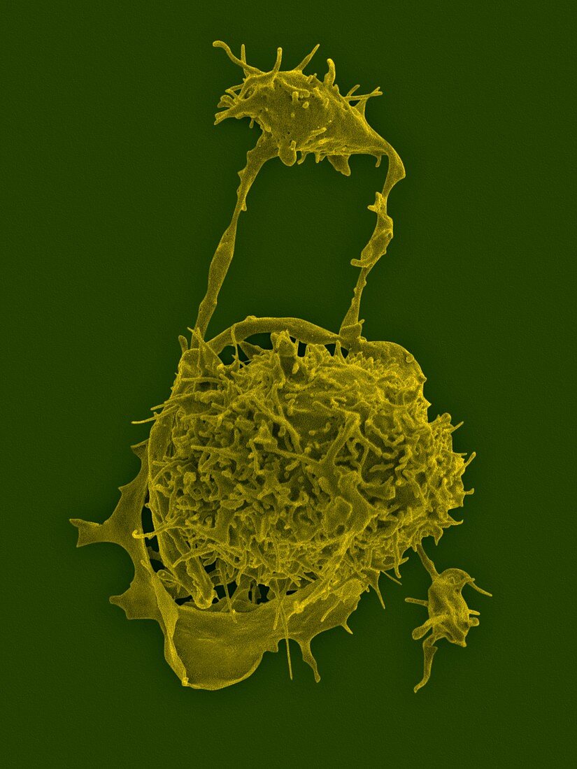Megakaryocyte and platelet formation, SEM
