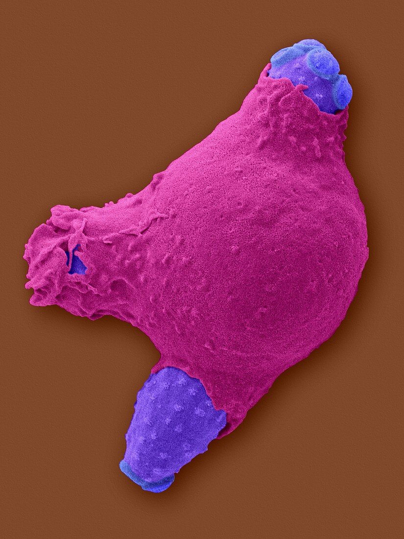 Neutrophil phagocytosis of Candida, SEM