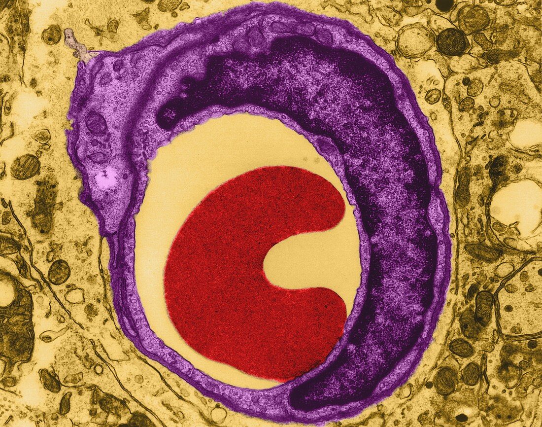 Red blood cell in a capillary, TEM