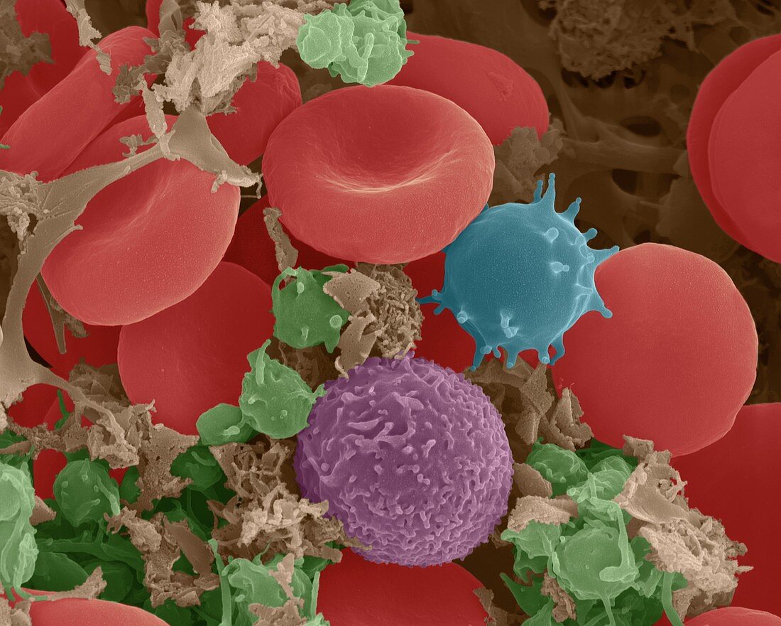 Human red and white blood cells, SEM