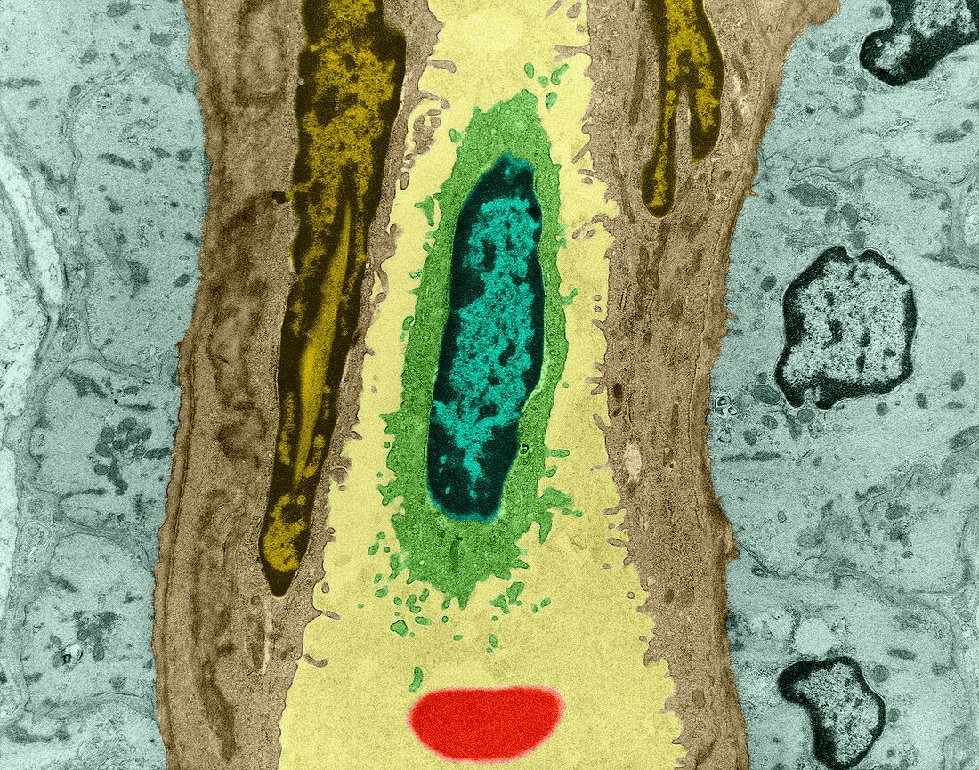 White blood cell in capillary, TEM