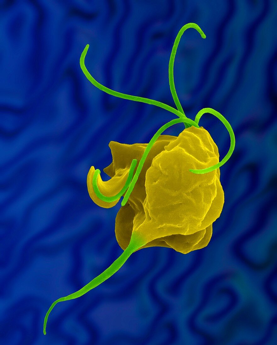 Trichomonas vaginalis parasitic protozoan, SEM