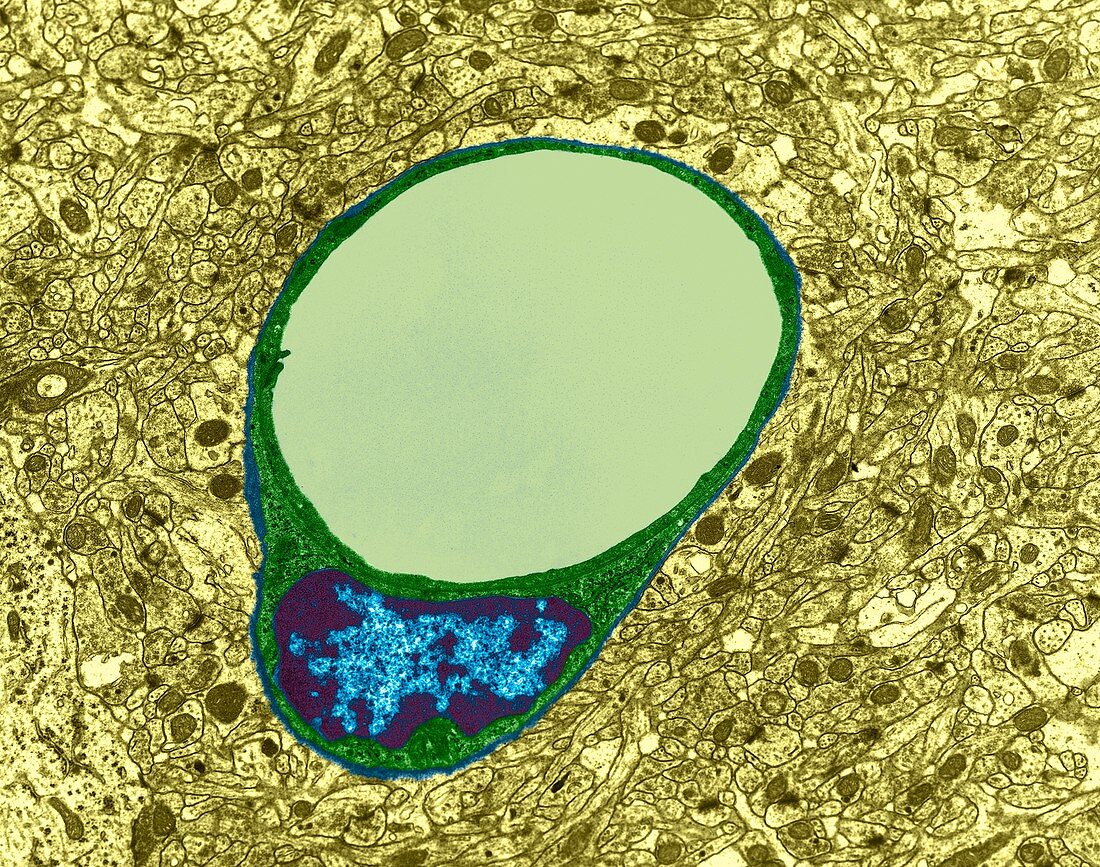 Capillary and endothelial cell, TEM