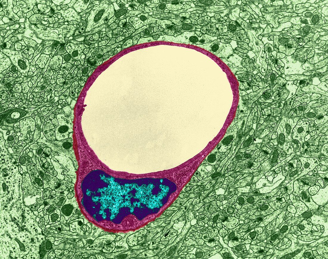 Capillary and endothelial cell, TEM