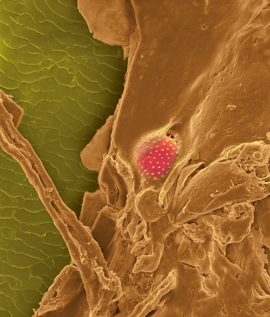 Nose hair with mucus and trapped pollen grain, SEM