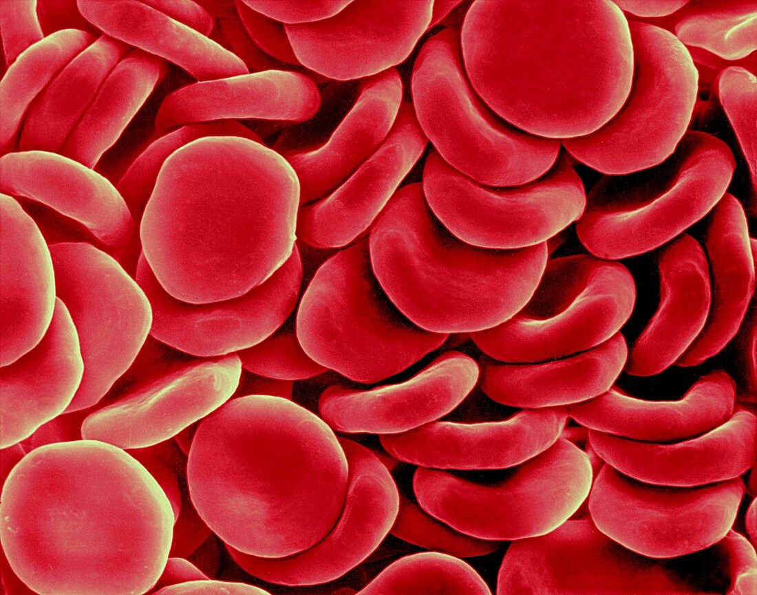 Red blood cells, SEM