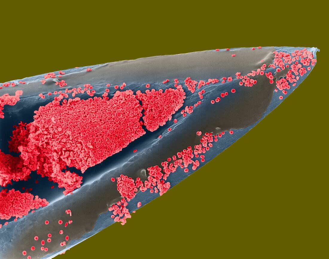 Hypodermic needle with blood, SEM