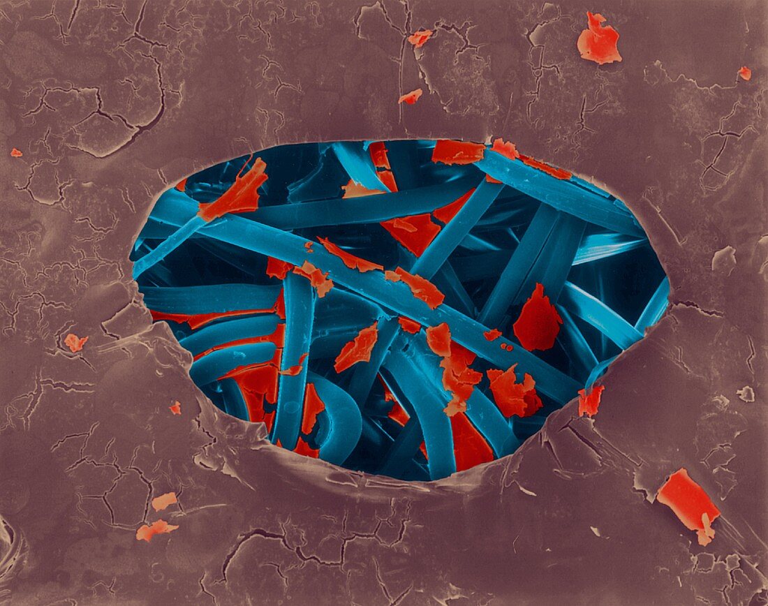 Band-aid with dried blood, SEM