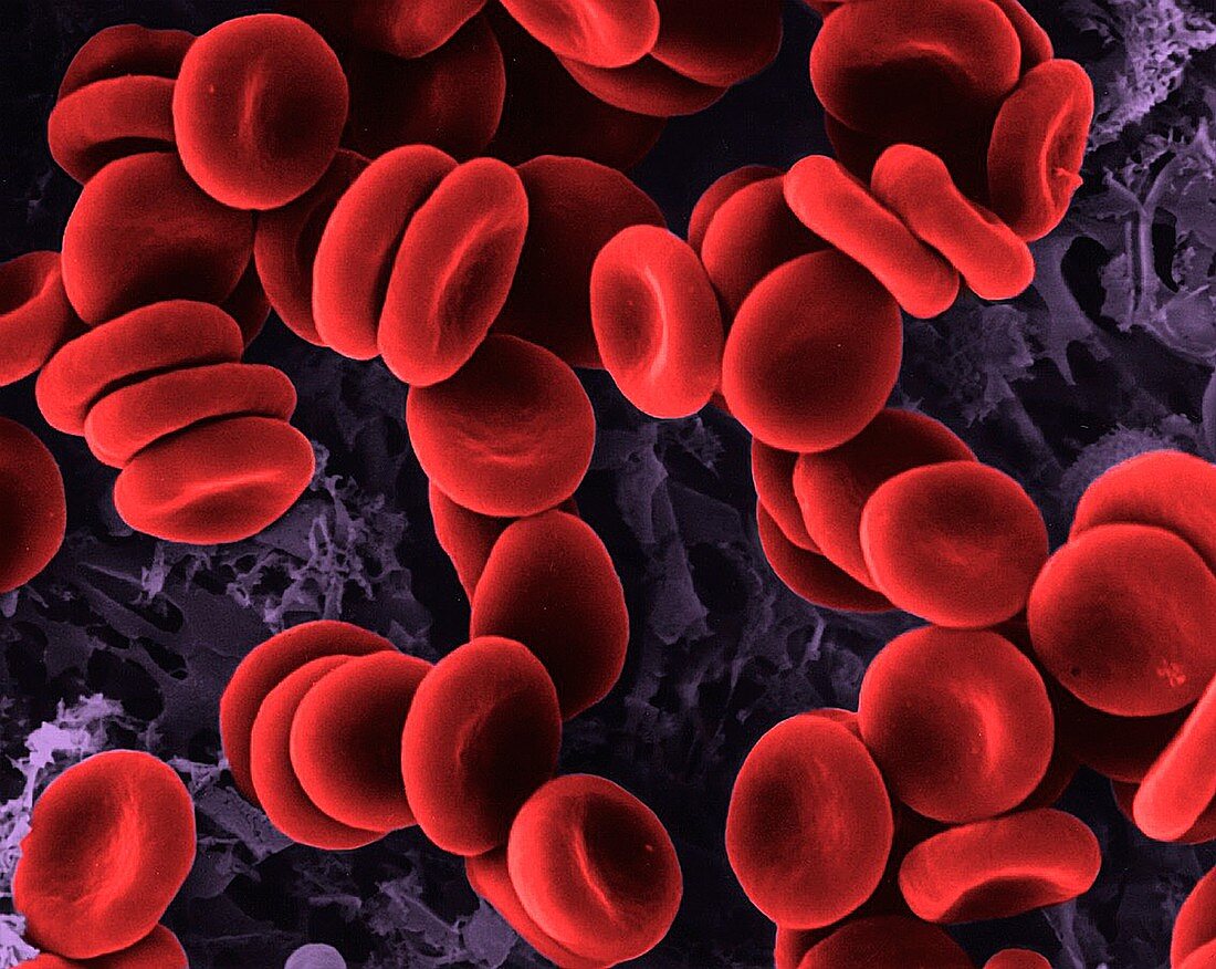 Red blood cells in isotonic solution, SEM