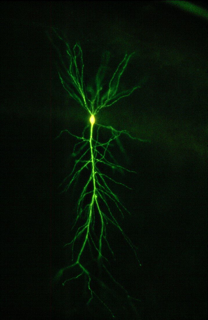 Hippocampus pyramidal neuron, LM Fluorescence
