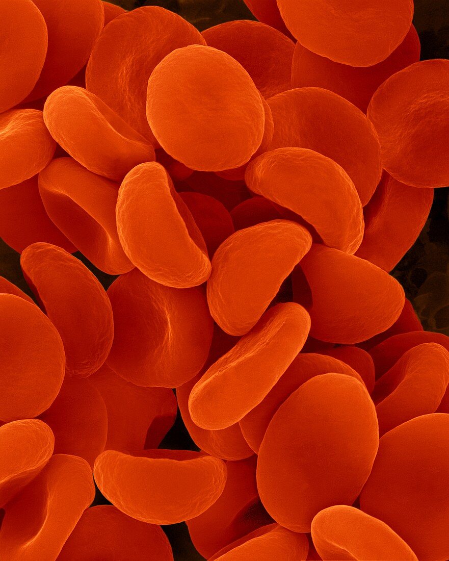 Red blood cells in hypotonic solution, SEM