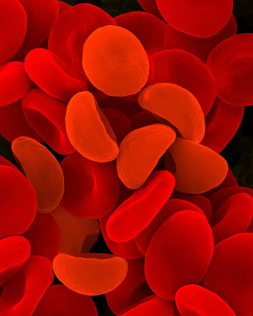 Red blood cells in hypotonic solution, SEM