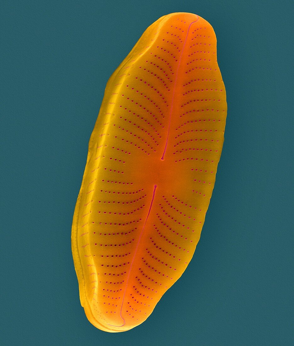 Moist soil pennate diatom (Navicula sp.), SEM