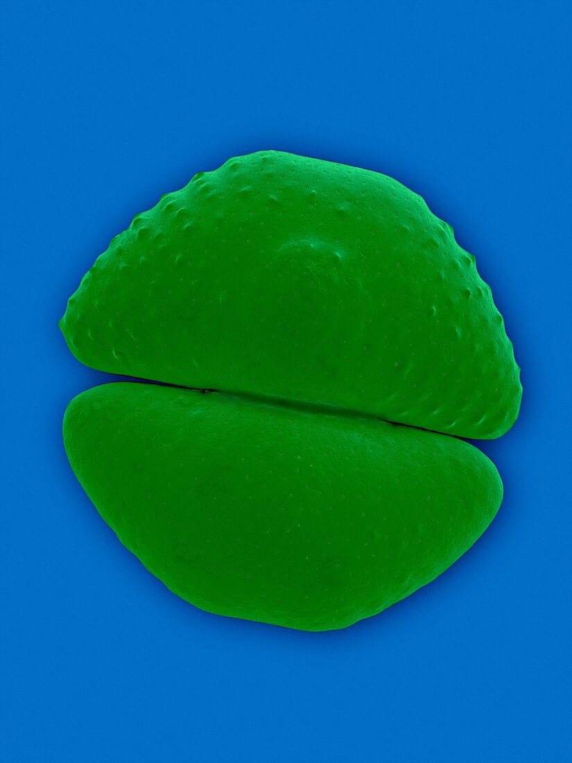 Placoderm desmid (Cosmarium botrytis), SEM