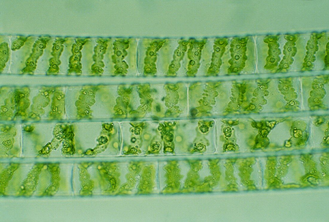 Spirogyra sp., filamentous green alga, LM