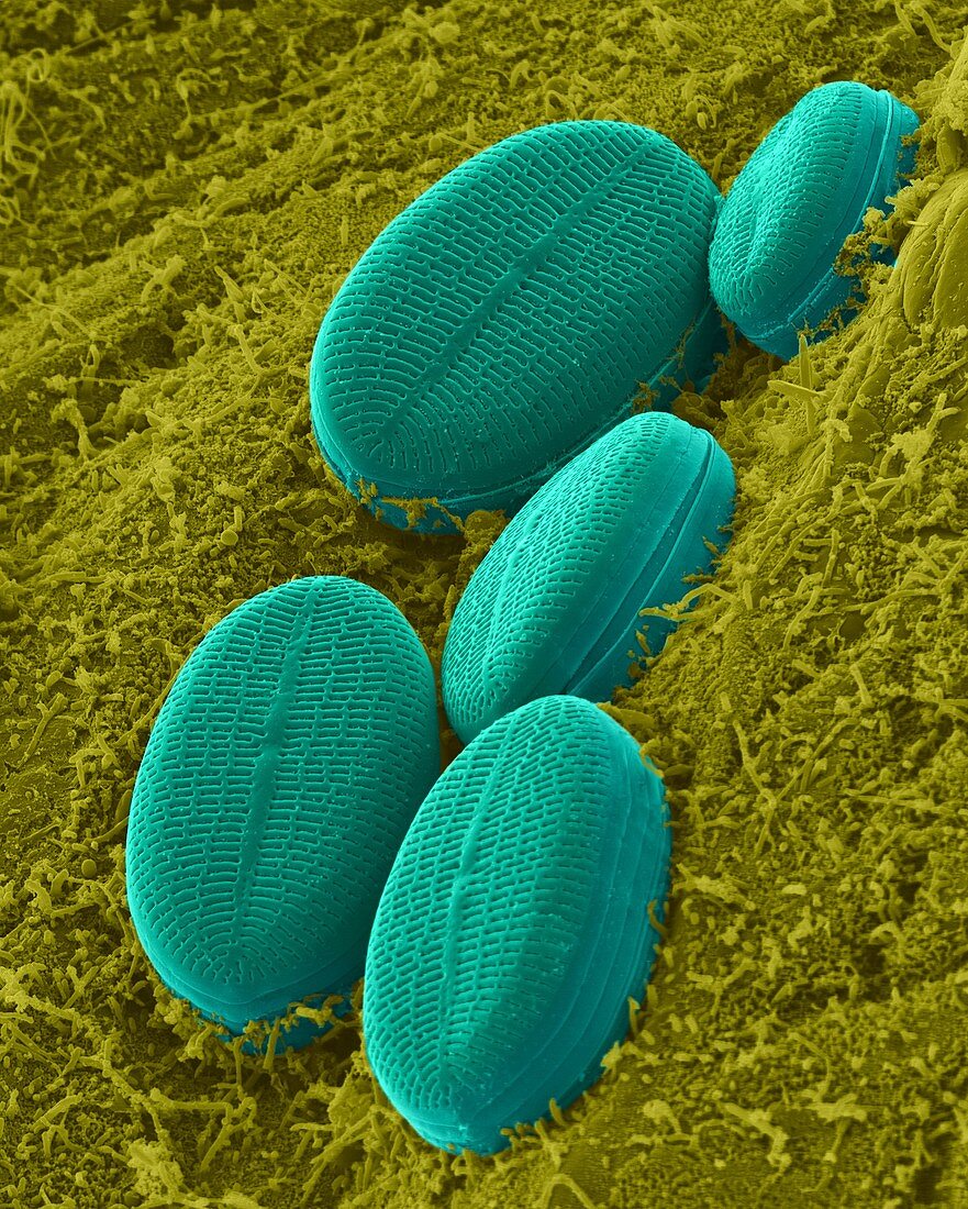 Fresh water pennate diatom, SEM
