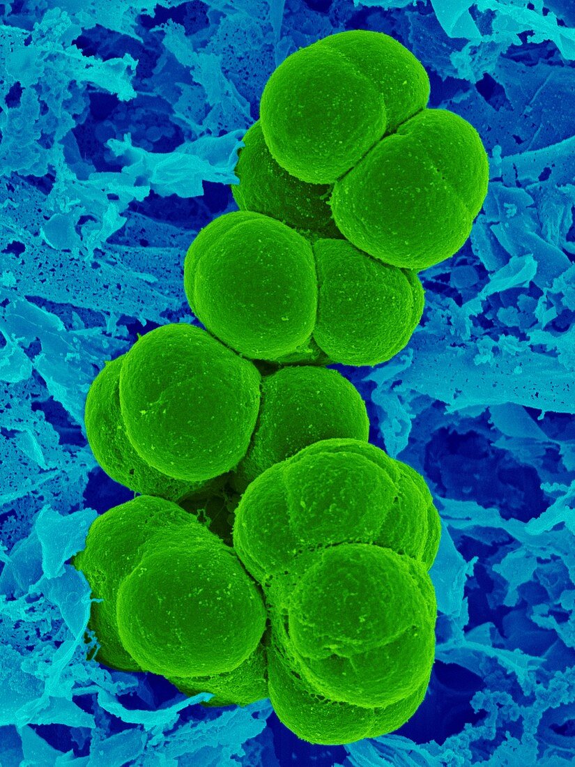 Methanotrophica archaea, SEM