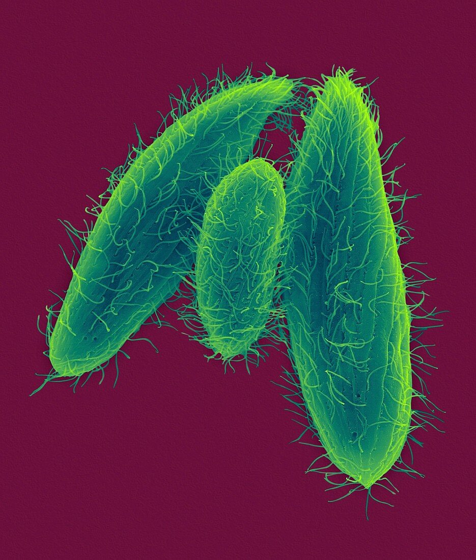 Ciliated protozoan (Tetrahymena vorax), SEM