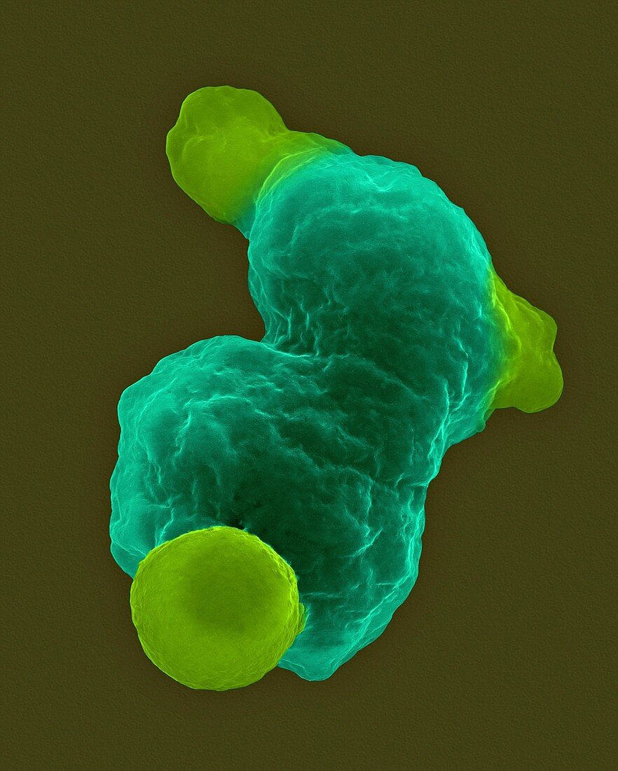 Parasitic amoeba (Entamoeba gingivalis) SEM