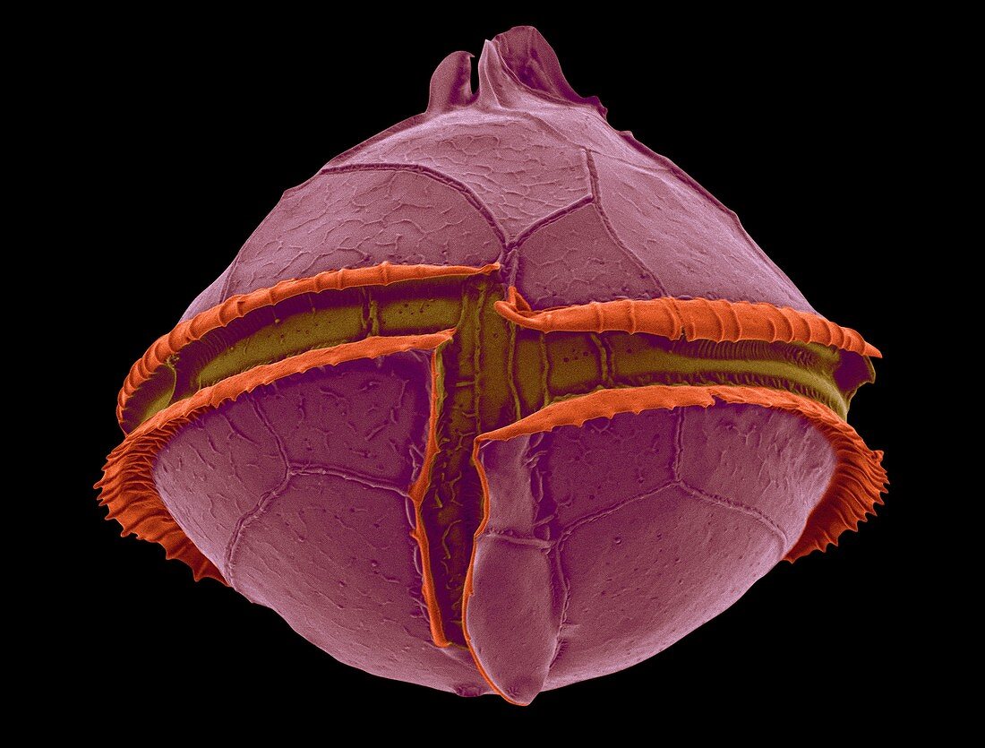 Heterotrophic dinoflagellate (Oblea sp.), SEM
