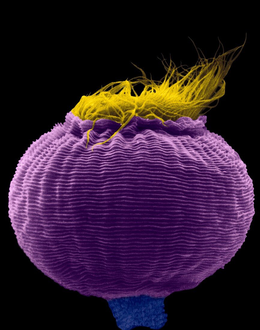 Protozoan (Vorticella sp.), SEM