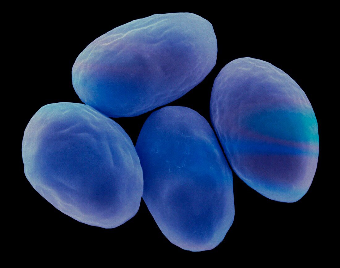 Giardia lamblia protozoan, SEM