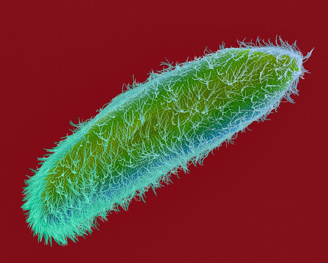 Ciliated protozoan (Paramecium sp.), SEM