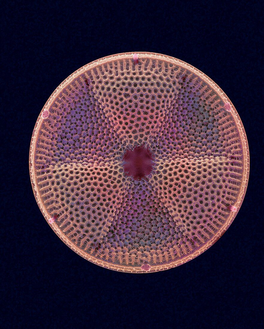 Actinoptychus heliopelta, SEM