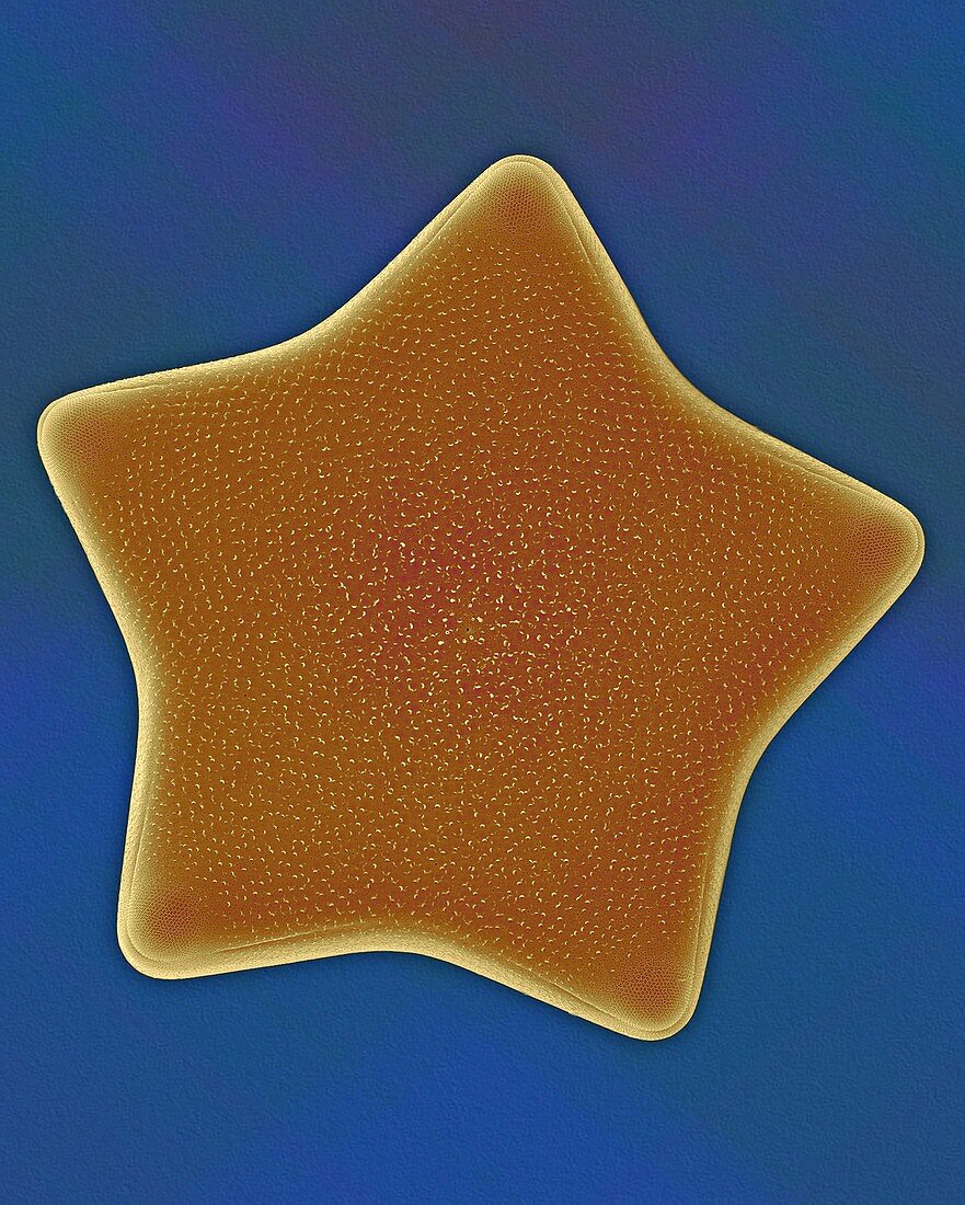 Marine diatom (Triceratium formosum), SEM