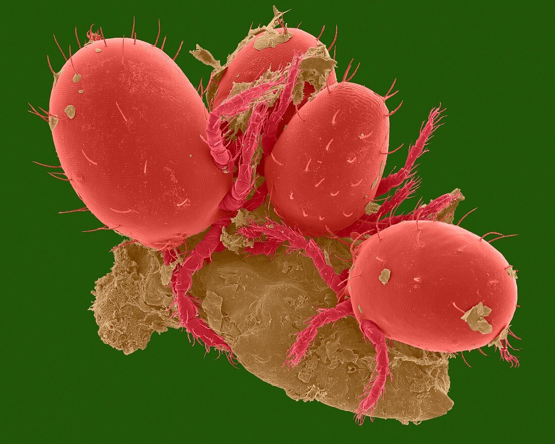 Chigger mites on human skin (Trombicula sp.), SEM