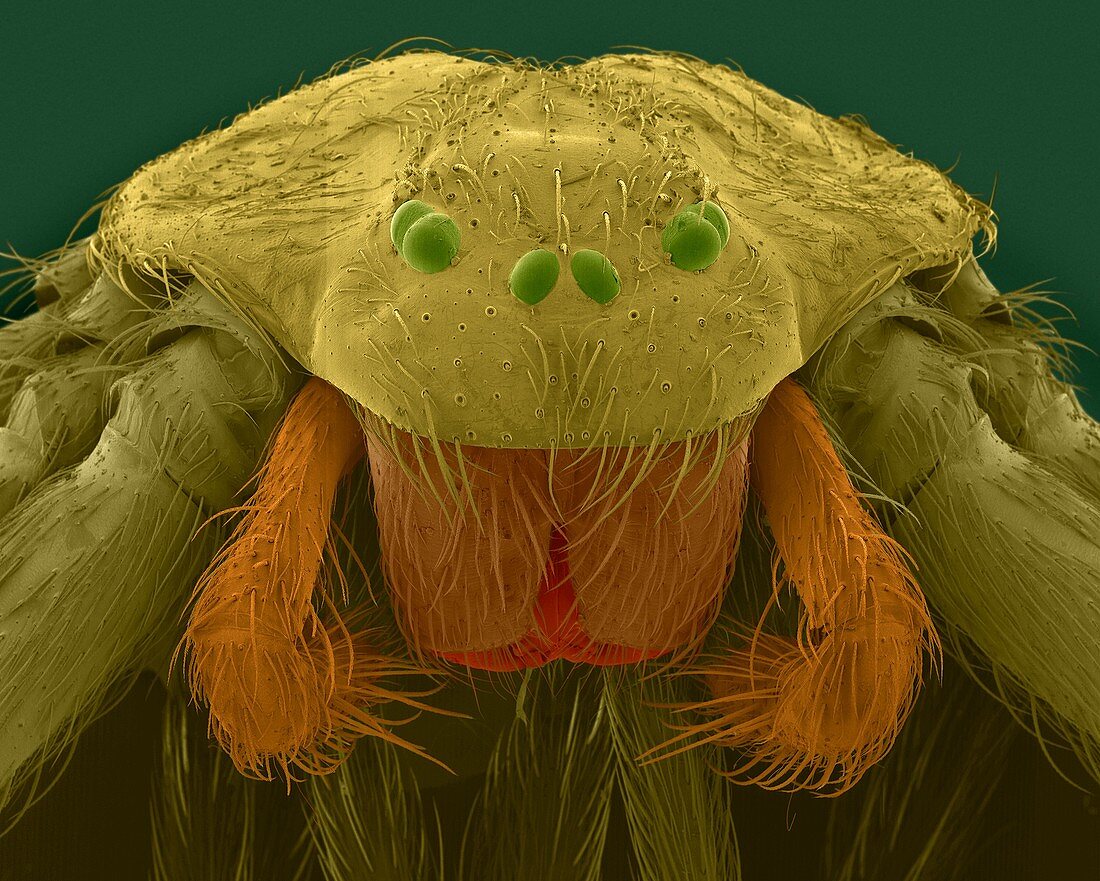 Brown recluse spider (Loxosceles reclusa), SEM
