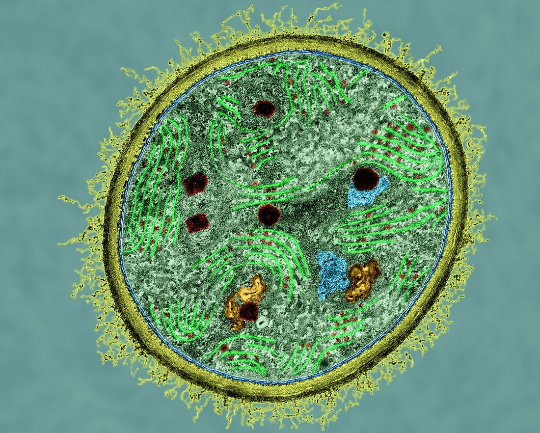 Cyanobacterium (Dermocarpa sp.), TEM
