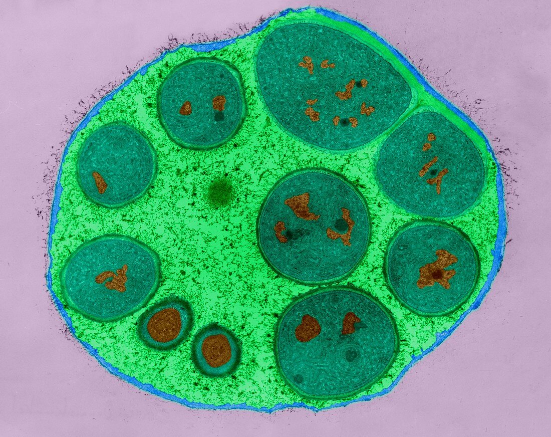 Cyanobacteria endospores (Dermocarpa sp.), TEM