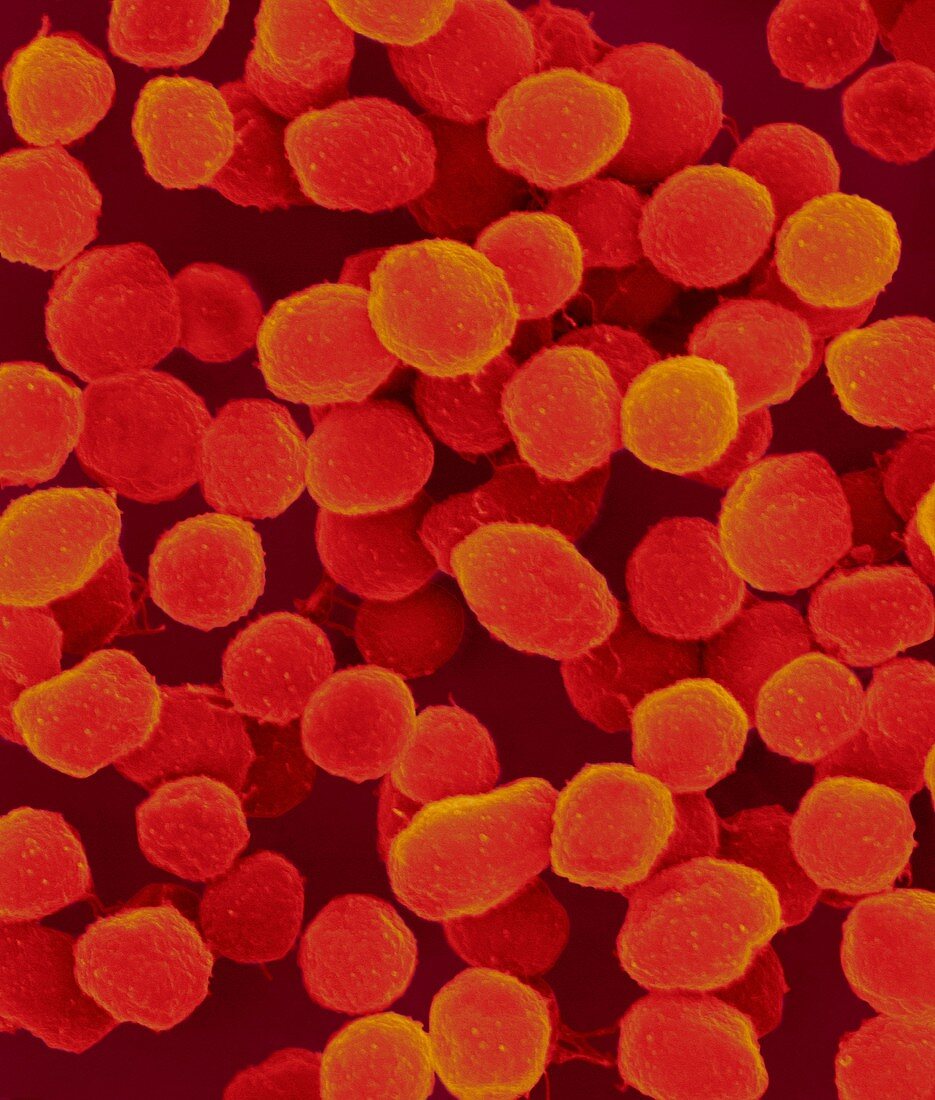 Methanococcus jannaschii archaea, SEM
