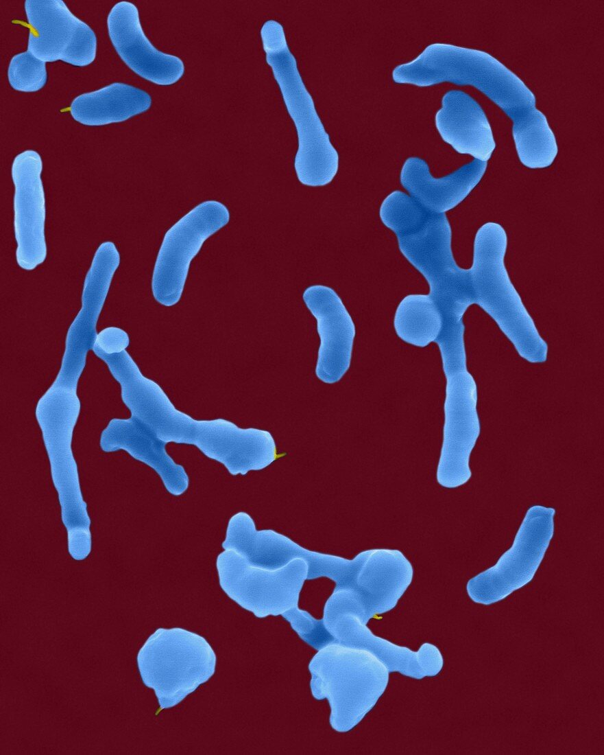 Helicobacter pylori, SEM